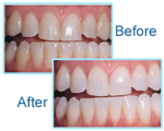 before-after